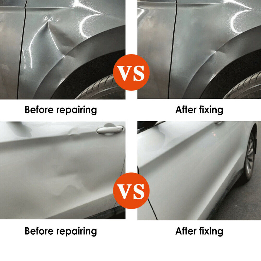 Great Choice Products Auto Body Repair Kits Puller Glue Tabs Combo Set Car Paintless Dent Removal Tool