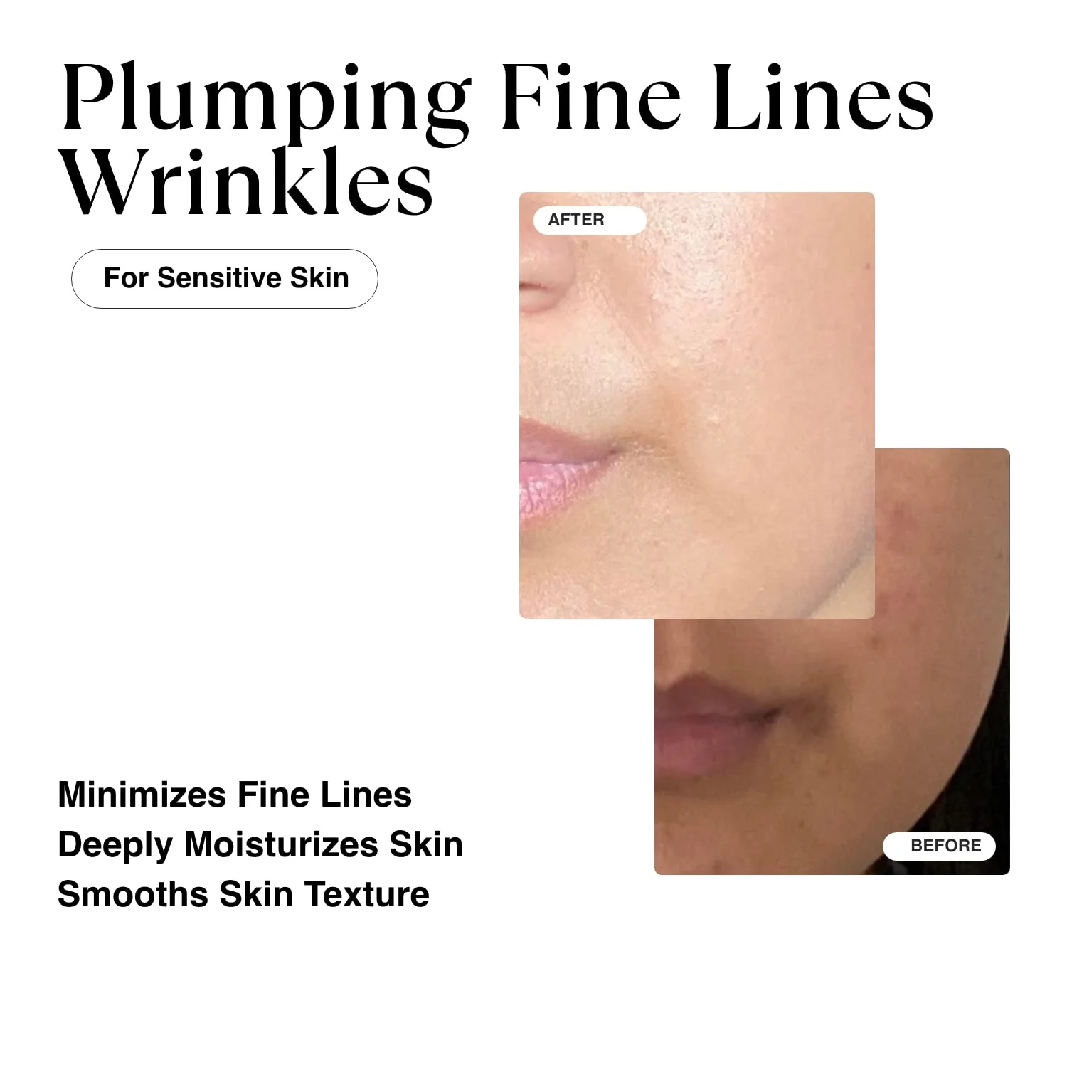 MATKAS Korean Triple Pure Hyaluronic Acid Serum for Face + 2% Niacinamide B3 + Vitamin B5 + 8 Peptides for Deep Firming, Plump W