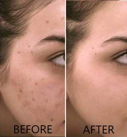 Dr. Brenner Vitamin C Serum 20% Pure L-Ascorbic Acid, Ferulic Acid, Vitamin E and HA and Hyaluronic Acid Serum with Vitamin B5 for Face and